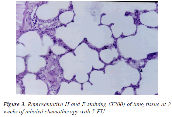 biomedres-inhaled-chemotherapy-5-FU