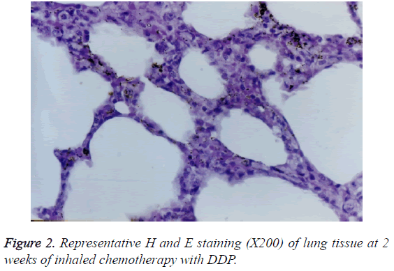 biomedres-inhaled-chemotherapy-DDP