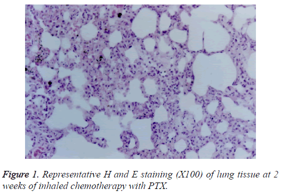 biomedres-inhaled-chemotherapy-PTX