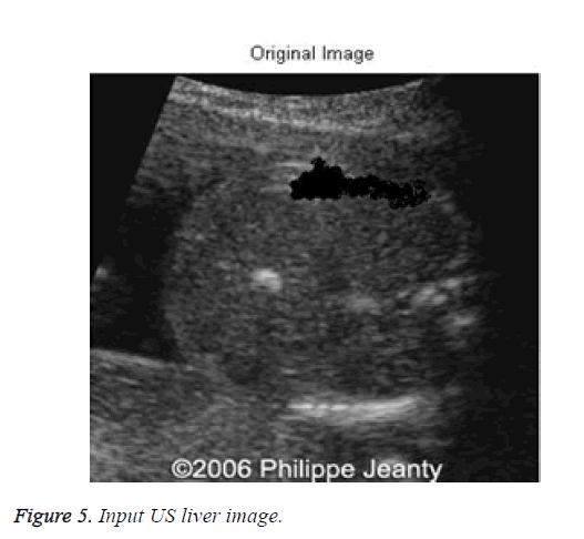 biomedres-input-liver-image