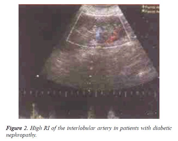 biomedres-interlobular-artery