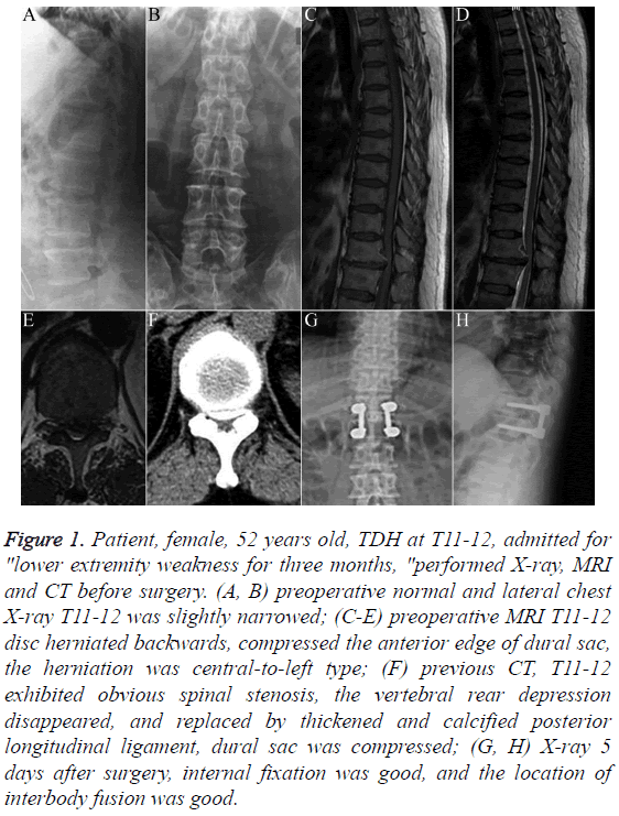 biomedres-internal-fixation