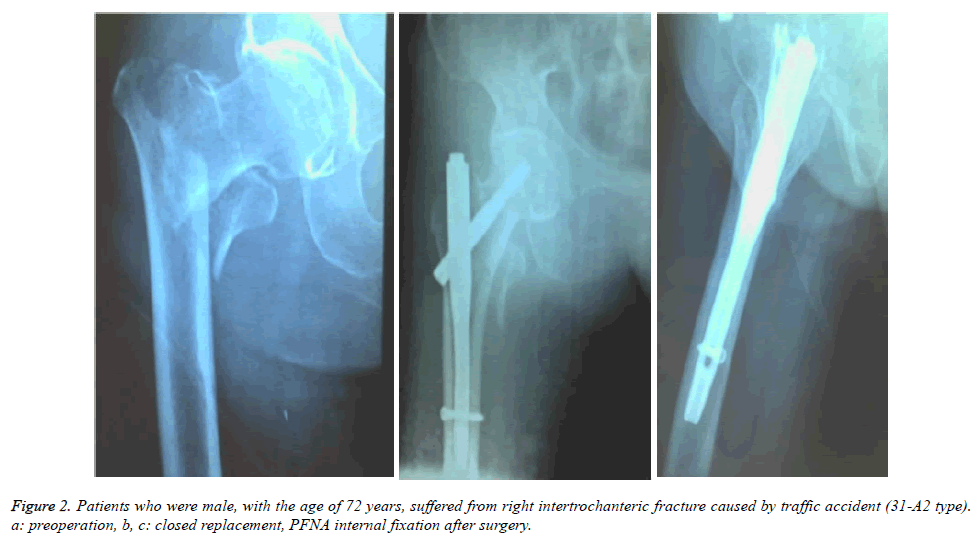 biomedres-internal-fixation