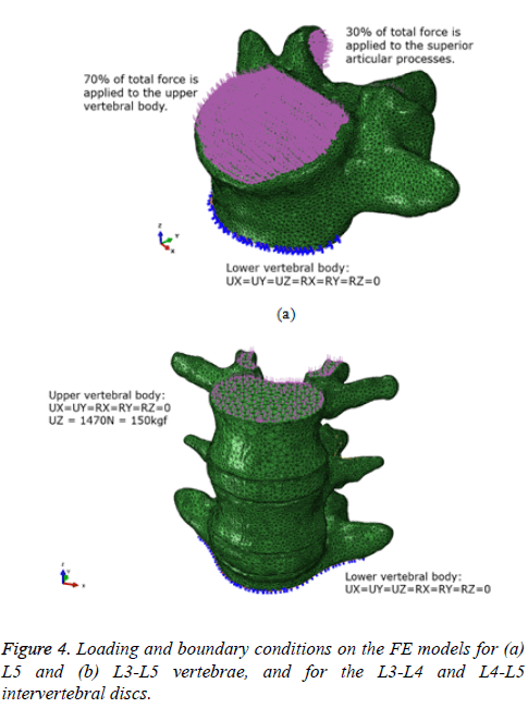 biomedres-intervertebral-discs