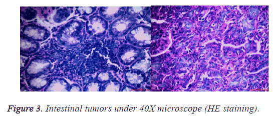 biomedres-intestinal-tumors