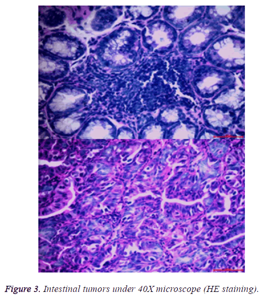 biomedres-intestinal-tumors