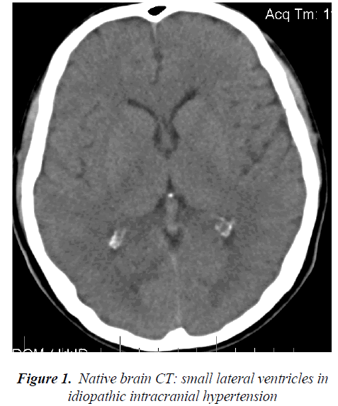 biomedres-intracranial-hypertension