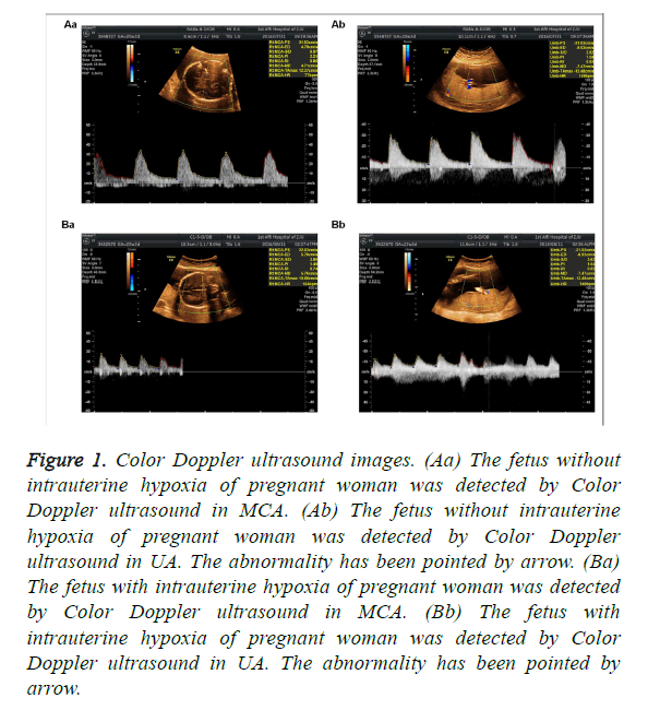 biomedres-intrauterine-hypoxia