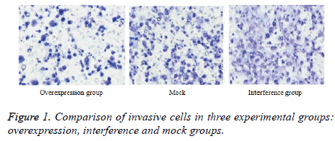 biomedres-invasive-cells