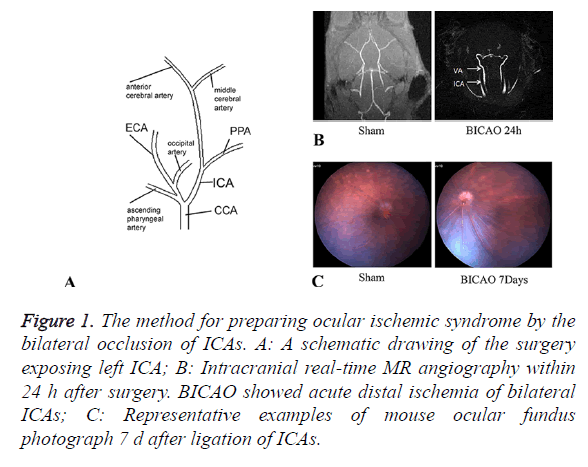 biomedres-ischemic-syndrome