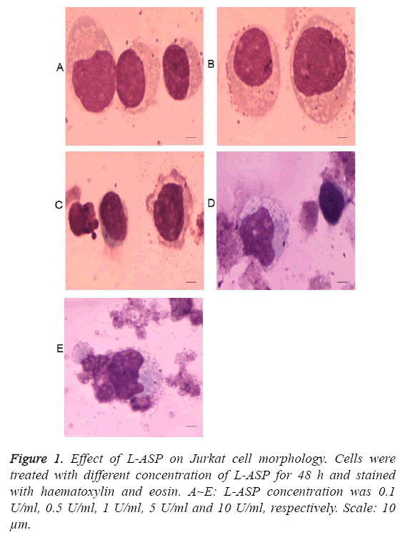 biomedres-jurkat-cell-morphology