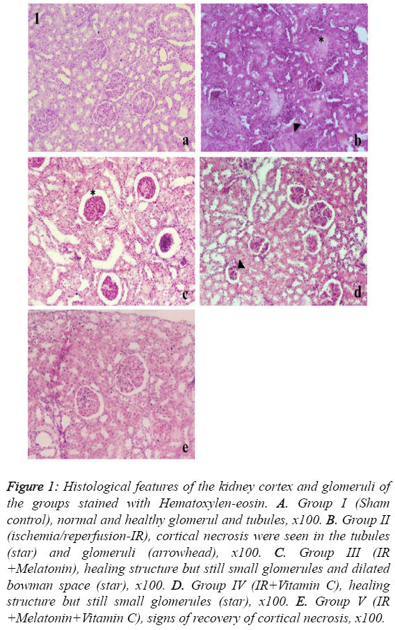 biomedres-kidney-cortex-glomeruli