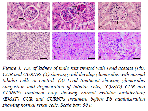 biomedres-kidney-male