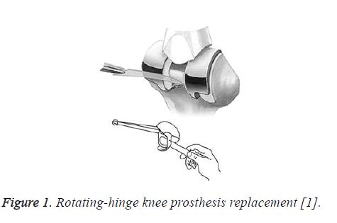 biomedres-knee-prosthesis-replacement