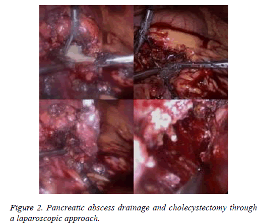 biomedres-laparoscopic-approach