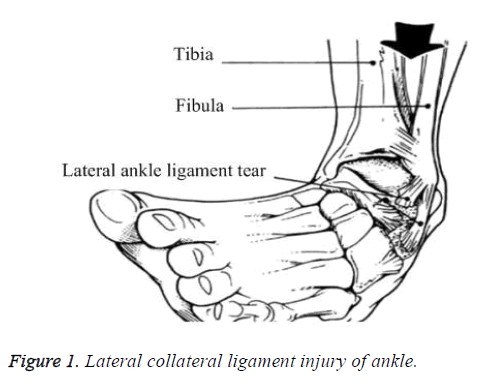 biomedres-lateral-collateral