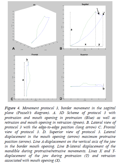 biomedres-lateral-displacement