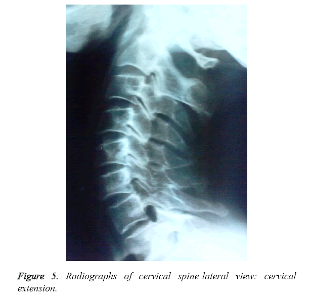 biomedres-lateral-view