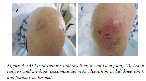 biomedres-left-knee-joint