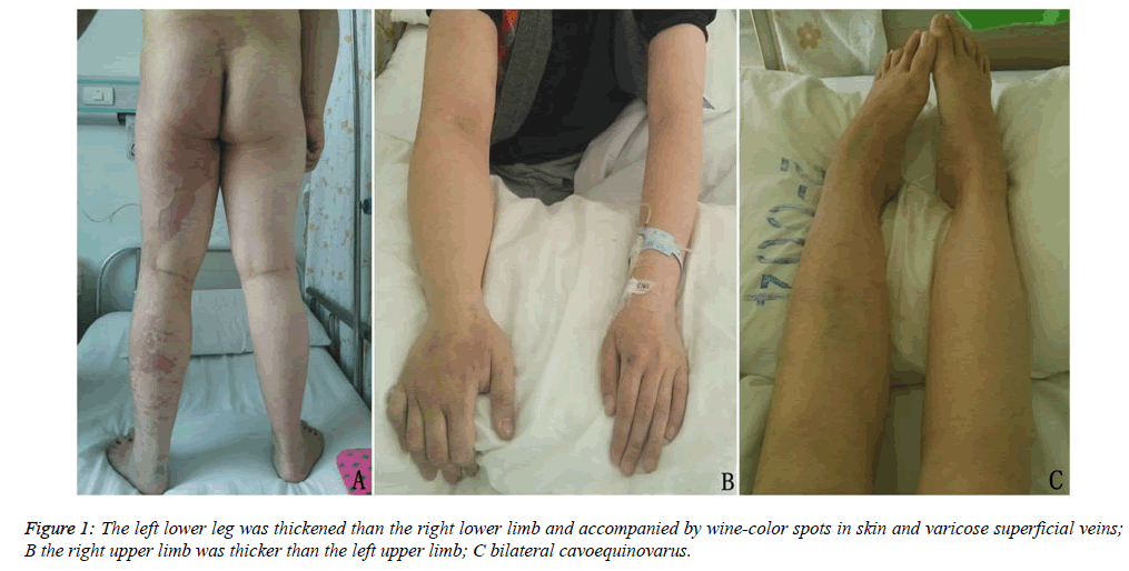 biomedres-left-lower-leg