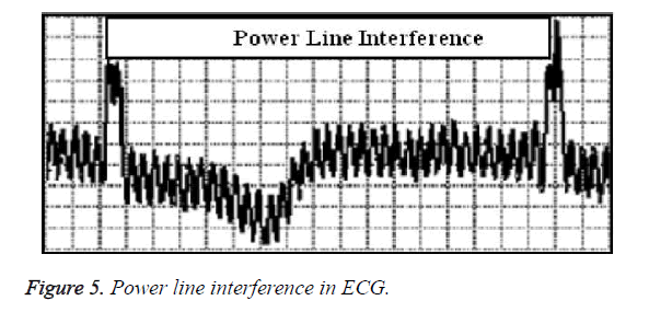 biomedres-line-interference