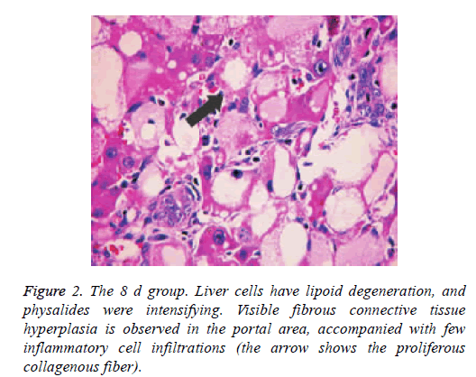 biomedres-lipoid-degeneration