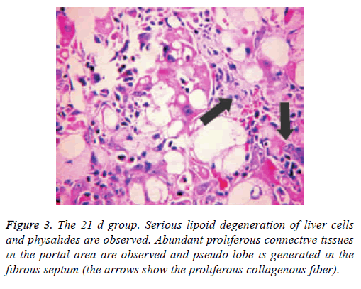 biomedres-lipoid-degeneration