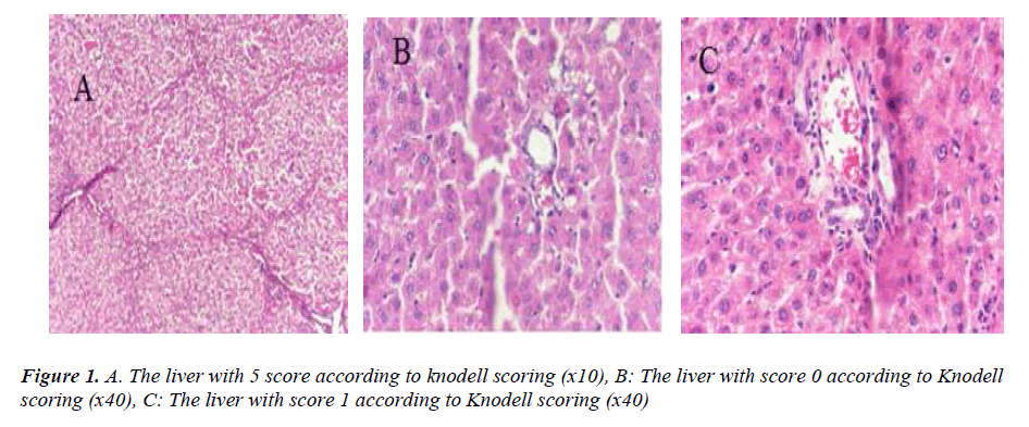 biomedres-liver-5-score-according-knodell-scoring