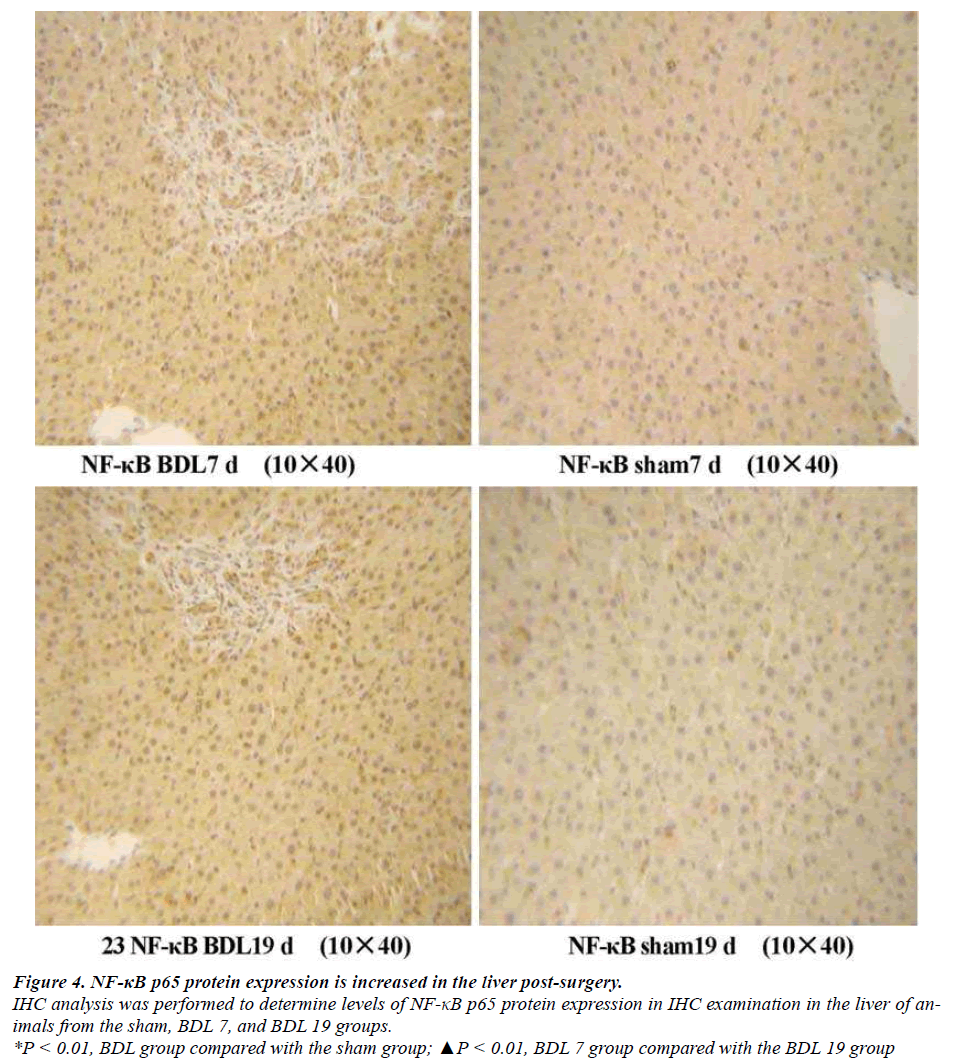 biomedres-liver-post-surgery