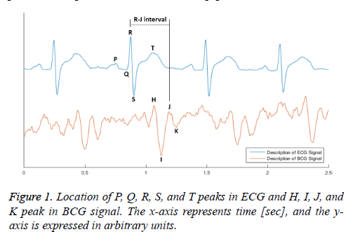 biomedres-location-BCG-signal