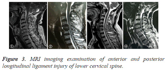 biomedres-lower-cervical-spine