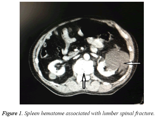 biomedres-lumber-spinal-fracture