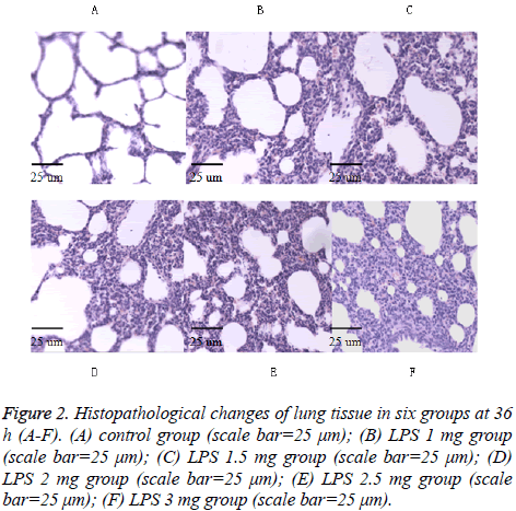 biomedres-lung-Histopathological