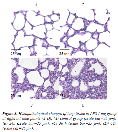 biomedres-lung-Histopathological