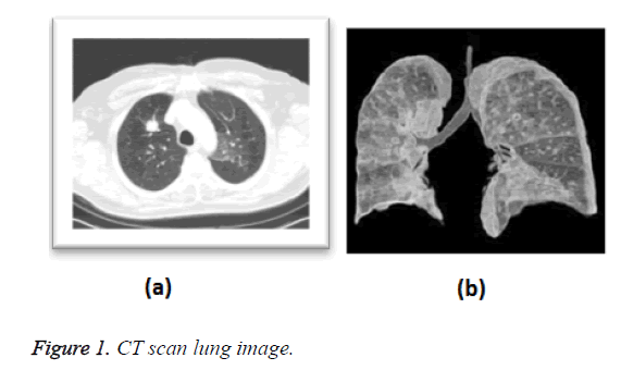 biomedres-lung-image