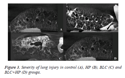 biomedres-lung-injury