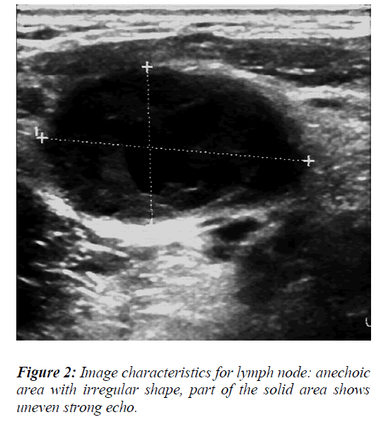 biomedres-lymph-node