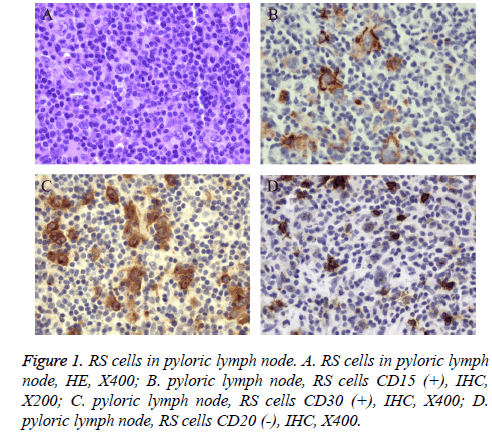 biomedres-lymph-node