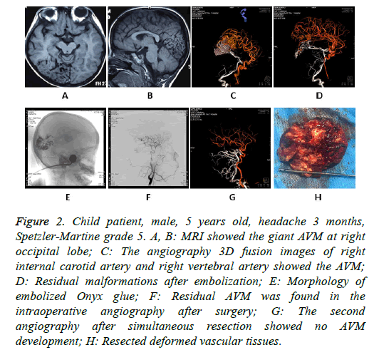 biomedres-lymph-syncope-angiography