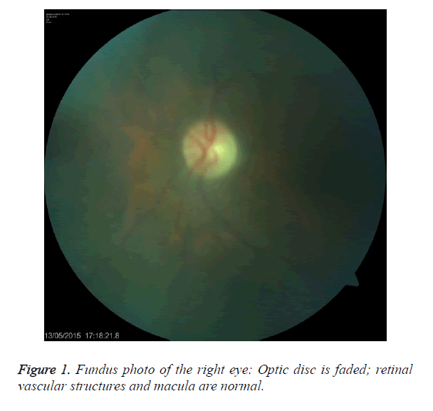 biomedres-macula-normal