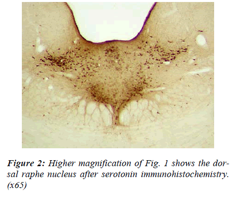 biomedres-magnification-serotonin-raphe