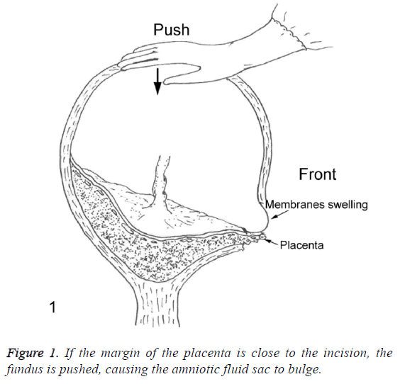 biomedres-margin-placenta