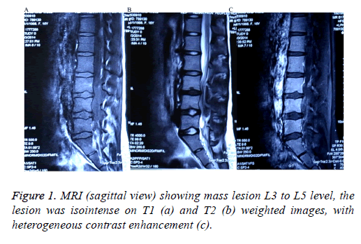 biomedres-mass-lesion