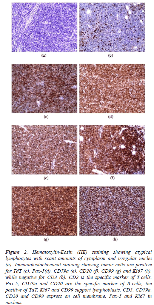 biomedres-mass-lesion