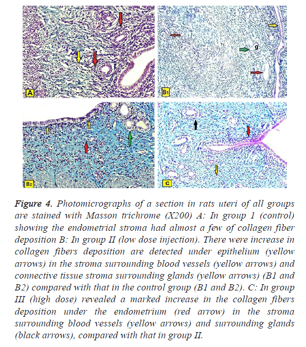 biomedres-masson-trichrome