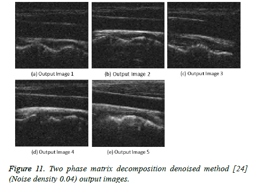 biomedres-matrix-decomposition