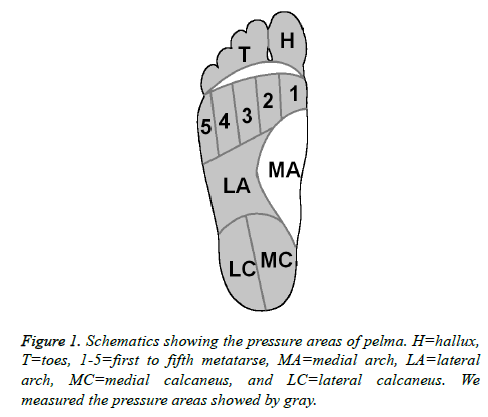 biomedres-medial-calcaneus