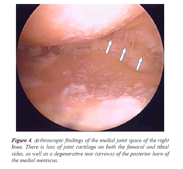 biomedres-medial-joint