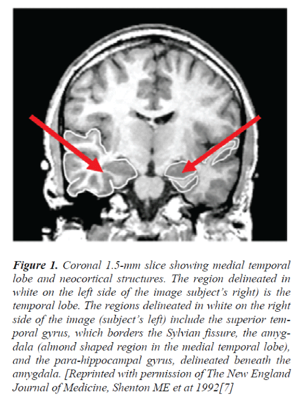 biomedres-medial-temporal-lobe