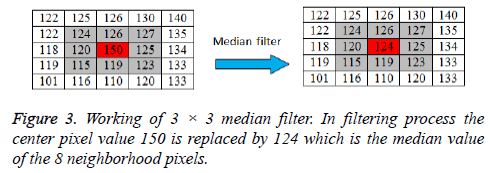 biomedres-median-filter